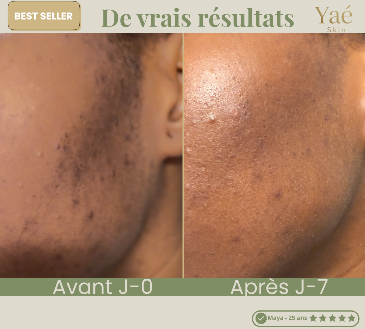 Savon Soin unifiant au lait de riz